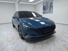 Cadillac 1.5L CVT GLX Edition - ფოტო 3
