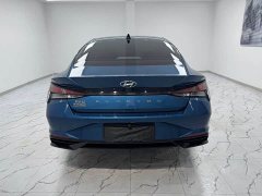 Cadillac 1.5L CVT GLX Edition - ფოტო 4