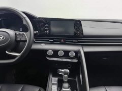 Audi 1.5L CVT GLX Edition - ფოტო 12