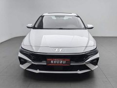 Audi 1.5L CVT GLX Edition - ფოტო 3