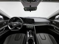 Audi 1.5L CVT GLX Edition - ფოტო 5