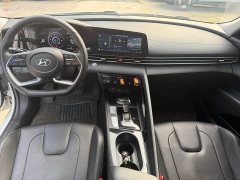 Lynk & Co 1.5L CVT LUXPremium Edition - ფოტო 5