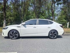 SAIC MG6 1.5T Edition - ფოტო 4