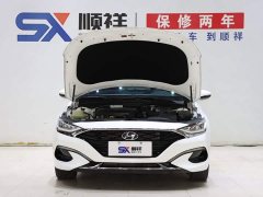 Hyundai Fiesta 280TGDi GLX Elite - ფოტო 19