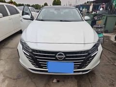Nissan Teana 2022 2.0L XL-TLS Comfort Edition - ფოტო 2