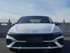 Hyundai Elantra 1.5L CVT Luxury - ფოტო 2