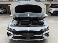 Hyundai Elantra 1.5L CVT Luxury - ფოტო 7