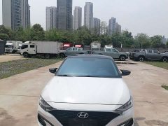 Hyundai Fiesta 2021 280TGDi DLX Luxury - ფოტო 2