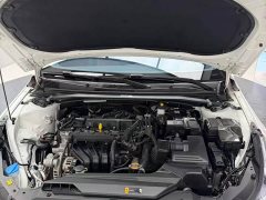 Hyundai Elantra 1.5L CVT TOP Premier Edition - ფოტო 10