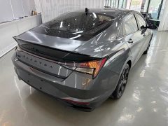Hyundai Elantra 1.5L CVT 20th Anniversary Edition - ფოტო 6