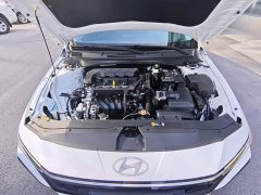 Hyundai Elantra 1.5L CVT GLS Leading Edition - ფოტო 15