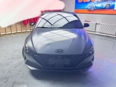 Hyundai Elantra 1.5L CVT 20th Anniversary Edition - ფოტო 2