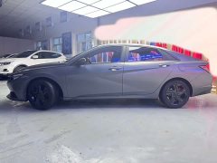 Hyundai Elantra 1.5L CVT 20th Anniversary Edition - ფოტო 6