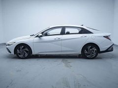 Hyundai Elantra 2023 1.5L CVT Luxury - ფოტო 2