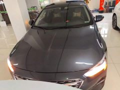 Buick Regal 552T Smart Comfort Edition - ფოტო 3