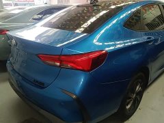 Buick Verano Pro GS Hunting Wind Edition - ფოტო 6