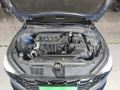 Hyundai Elantra 1.5L CVT GLX Elite - ფოტო 20