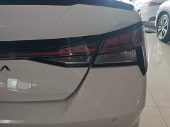 Hyundai Elantra 1.5L CVT 20th Anniversary Edition - ფოტო 5