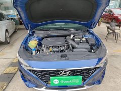 Hyundai Fiesta 280TGDi GLX Elite - ფოტო 20