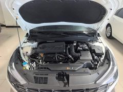 Hyundai Elantra 240TGDi DCT LUX Luxury Edition - ფოტო 16