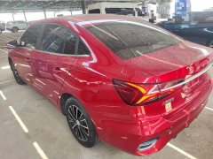 SAIC MG i5 1.5L CVT Diamond Edition - ფოტო 5