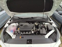 SAIC MG5 180DVVT Global Luxury Edition - ფოტო 20