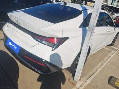 Hyundai Elantra 2023 1.5L CVT GLX Elite - ფოტო 3