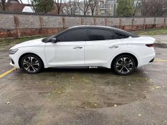 Hyundai Fiesta 280TGDi DLX Luxury - ფოტო 4
