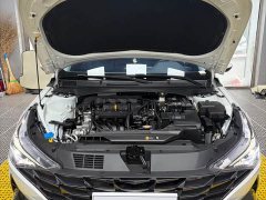 Hyundai Elantra 1.5L CVT Luxury - ფოტო 9