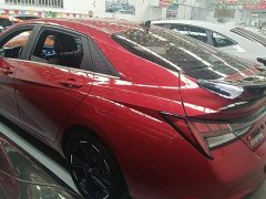 Hyundai Elantra 2022 240TGDi DCT LUX Luxury Edition - ფოტო 3