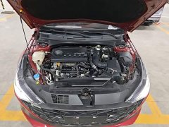 Hyundai Elantra 240TGDi DCT LUX Luxury Edition - ფოტო 20