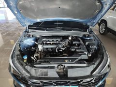 Hyundai Elantra 1.5L CVT Luxury - ფოტო 20