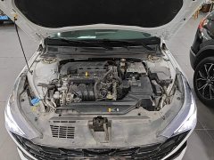 Hyundai Elantra 1.5L CVT Luxury - ფოტო 20