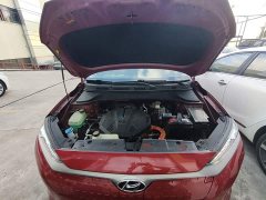 Hyundai Kona Electric 2020 GLS Smart Edition - ფოტო 20