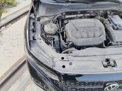 Volkswagen Passat Facelift 330TSI Starry Sky Elite - ფოტო 18