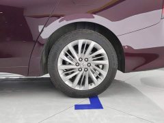 Buick Century 2.0T Six-Seat Yun Shi Edition - ფოტო 6