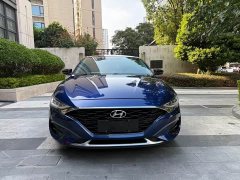 Hyundai Fiesta 280TGDi Luxury SportPlus Edition - ფოტო 3