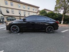 SAIC MG5 Scorpio 1.5T Luxury - ფოტო 4