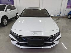 Hyundai Elantra 2023 1.5L CVT GLX Elite - ფოტო 2