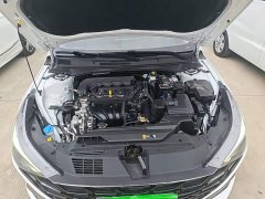 Hyundai Elantra 2022 1.5L CVT Luxury - ფოტო 19