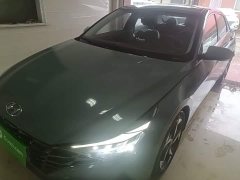 Hyundai Elantra 1.5L CVT Luxury - ფოტო 1