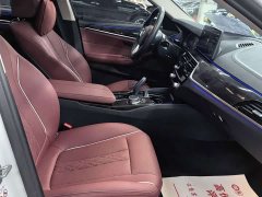 BMW 5 Series Facelift 525Li Luxury Package - ფოტო 9