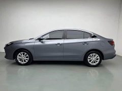 SAIC MG i5 1.5L CVT Luxury - ფოტო 3