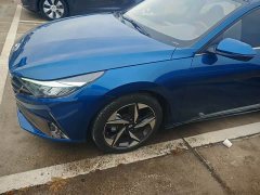 Hyundai Elantra 1.5L CVT Luxury - ფოტო 2
