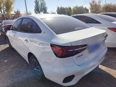 SAIC MG i5 1.5L Manual Platinum Edition - ფოტო 4