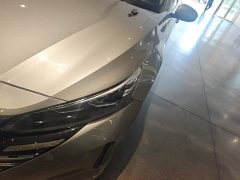 Nissan Teana 2.0L XL-TLS Comfort Edition - ფოტო 5
