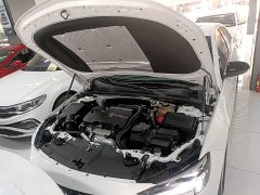 Buick Regal 552T Smart Comfort Edition - ფოტო 19