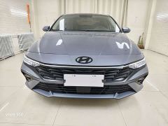 Hyundai Elantra 240TGDi DCT N Line GLX Elite - ფოტო 2