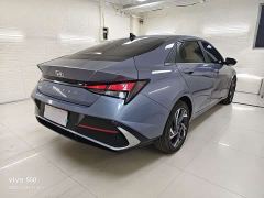 Hyundai Elantra 240TGDi DCT N Line GLX Elite - ფოტო 4