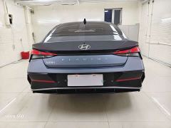 Hyundai Elantra 240TGDi DCT N Line GLX Elite - ფოტო 5